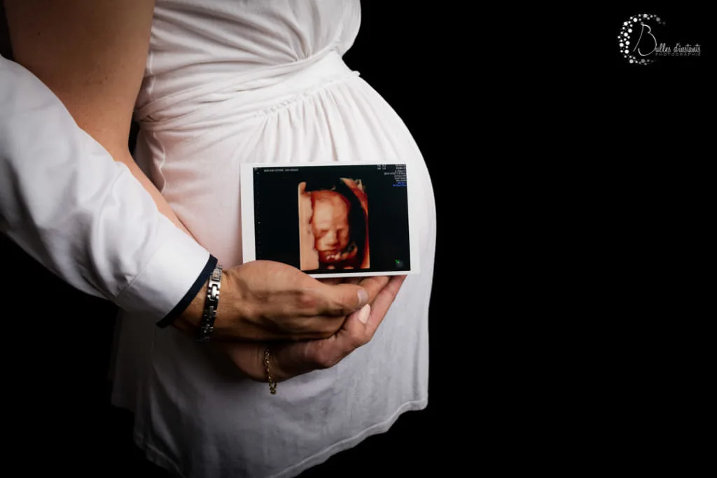 photo future maman studio yvelines 78